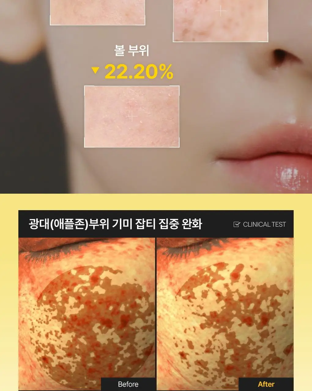 [단독기획] 메디힐 콜라겐 캡슐 패치 60+60매 더블 기획 2종 (레티놀, 비타민C) 상세페이지 27
